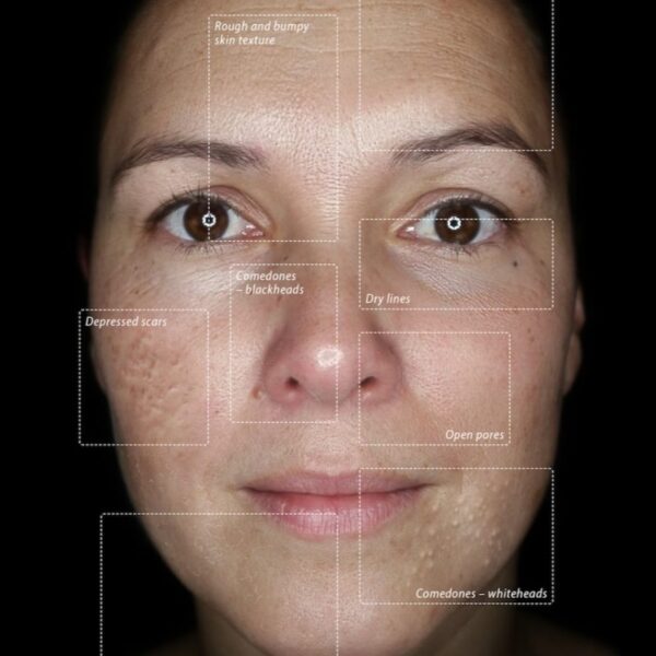 parallel-polarised-1-800x800